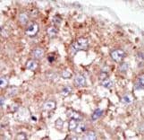 PTK6 / BRK Antibody (aa11-41)