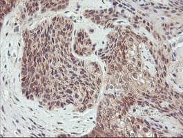 AGPAT5 Antibody (clone OTI2C4)