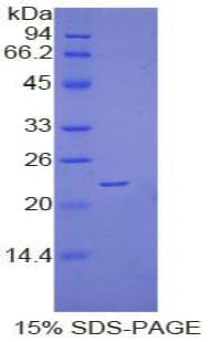 Human VEGFB Protein (Recombinant His-T7)