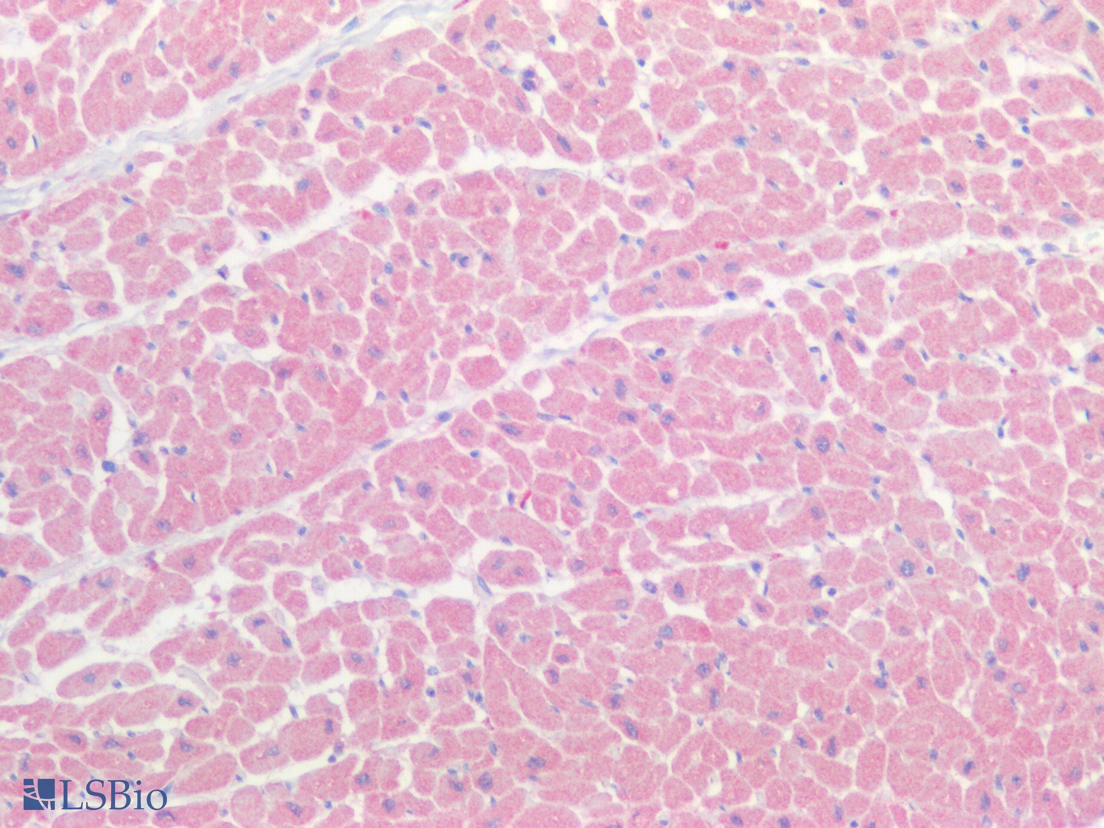 IHC-plus™ Monoclonal Mouse anti-Human DMPK / DM Antibody (clone 2F7, IHC, WB)