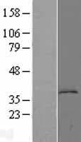 KYNU Protein (Over-Expression Lysate Myc-DDK (Flag))
