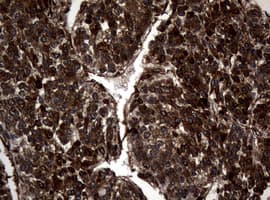 SKIL / SNO / SnoN Antibody (clone OTI2C9)