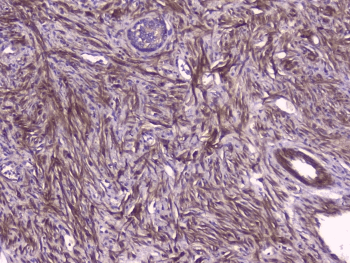 PEBP1 / RKIP Antibody