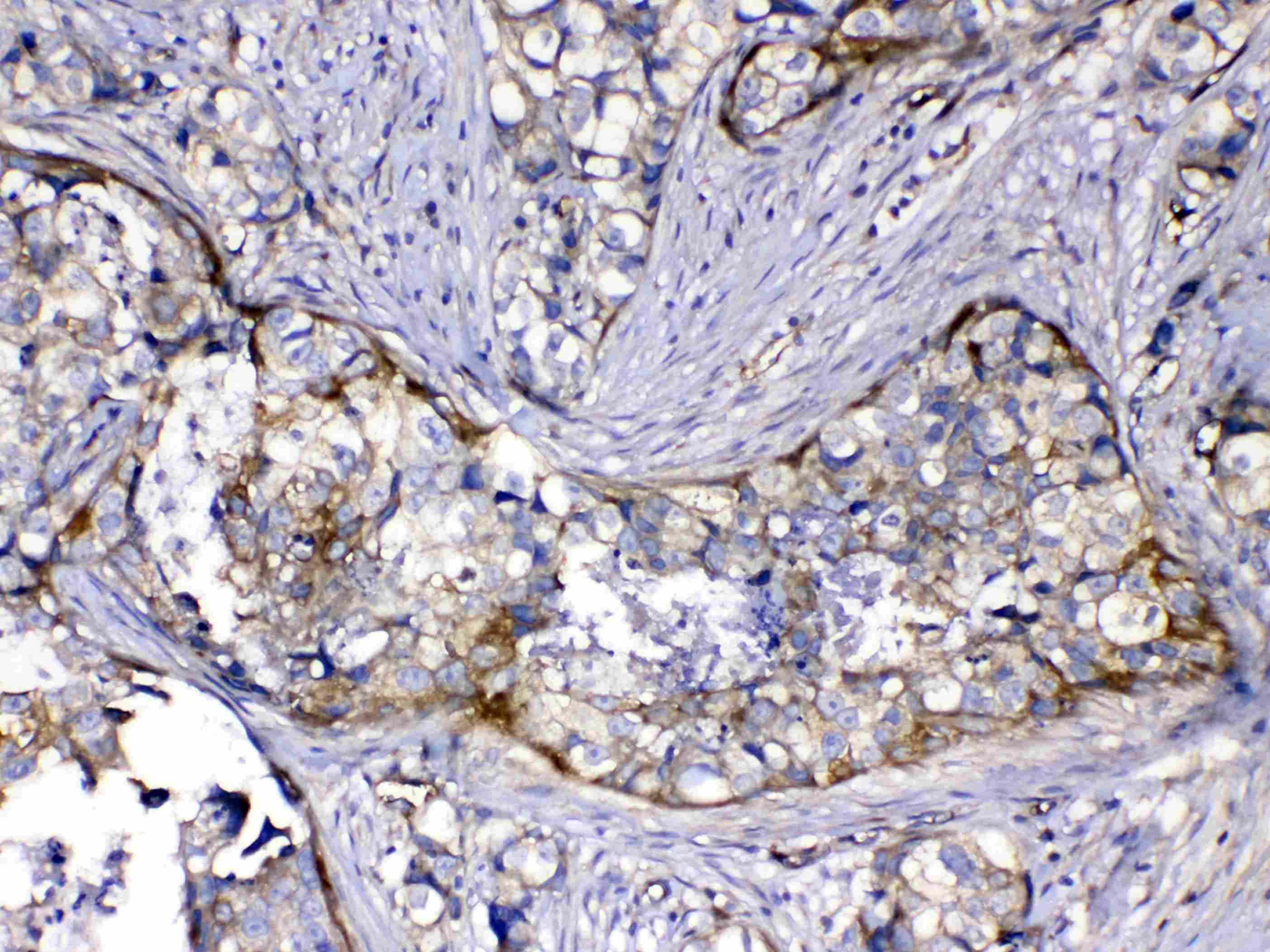 HOMER3 / Homer 3 Antibody