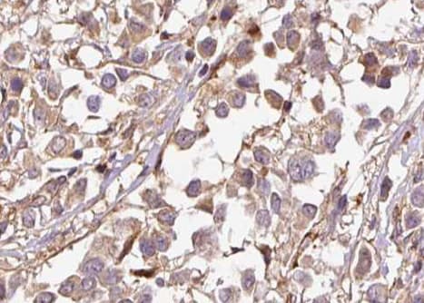 Polyclonal Rabbit anti-Human CDKN1A / WAF1 / p21 Antibody (phospho-Thr145, IHC, IF, WB)