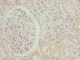 IHC-plus™ SGCA / DAG2 Antibody