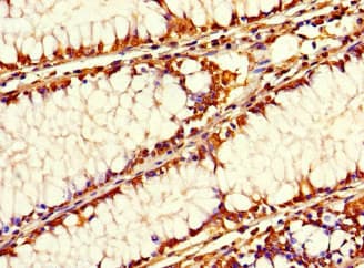 SIRPB1 / CD172b Antibody
