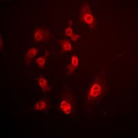 SMAD4 Antibody (N-Terminus)