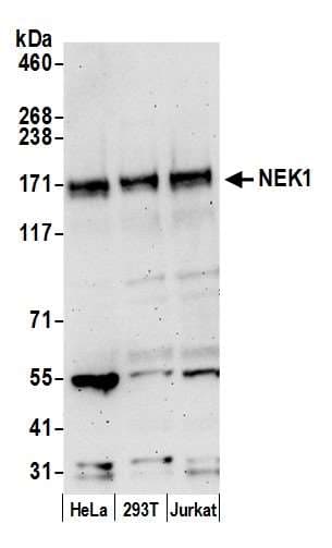 NEK1 Antibody (aa1208-1258)