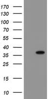 SNAI2 / SLUG Antibody (clone OTI4E1)