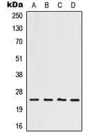 Polyclonal Rabbit anti-Human HOXB7 Antibody (Internal, WB)