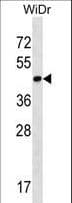 CTG-B45d / THAP11 Antibody (aa67-96)