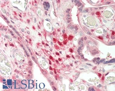IHC-plus™ Polyclonal Rabbit anti-Human S100A6 / Calcyclin Antibody (IHC)