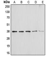 IHC-plus™ Polyclonal Rabbit anti-Human ANXA1 / Annexin A1 Antibody (Internal, IHC, IF, WB)