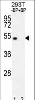 IHC-plus™ Polyclonal Rabbit anti-Human E2F1 Antibody (aa342-371, IHC, WB)