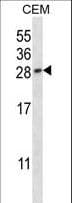 IHC-plus™ PGF / PLGF Antibody (aa120-148)