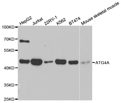 Polyclonal Rabbit anti-Human ATG4A Antibody (IHC, WB)