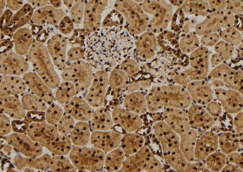 DES / Desmin Antibody
