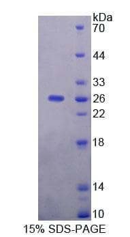 Human NIN / Ninein Protein (Recombinant His-T7)