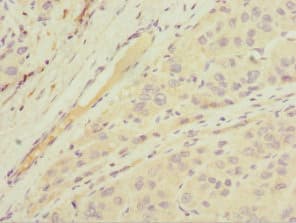 MGAT / GLYT1 Antibody