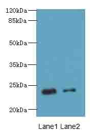 Polyclonal Rabbit anti-Human RD3 Antibody (IHC, WB)