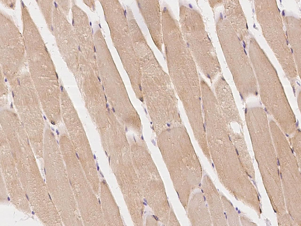 Polyclonal Rabbit anti-Human RAB7A / RAB7 Antibody (IHC, IF)