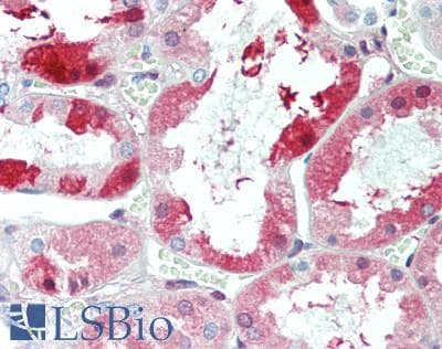 IHC-plus™ Polyclonal Rabbit anti-Human UCN / Urocortin Antibody (40-120 aa, C-terminal, IHC)