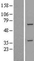 DDX31 Protein (Over-Expression Lysate Myc-DDK (Flag))
