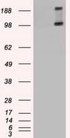 TRPM4 Antibody (clone OTI14F1, Carrier-free)