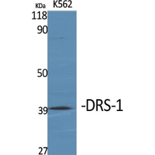 ECI2 / PECI Antibody (50-130 aa, Internal)