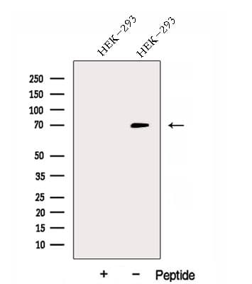 Polyclonal Rabbit anti-Human DNAJC21 Antibody (WB)