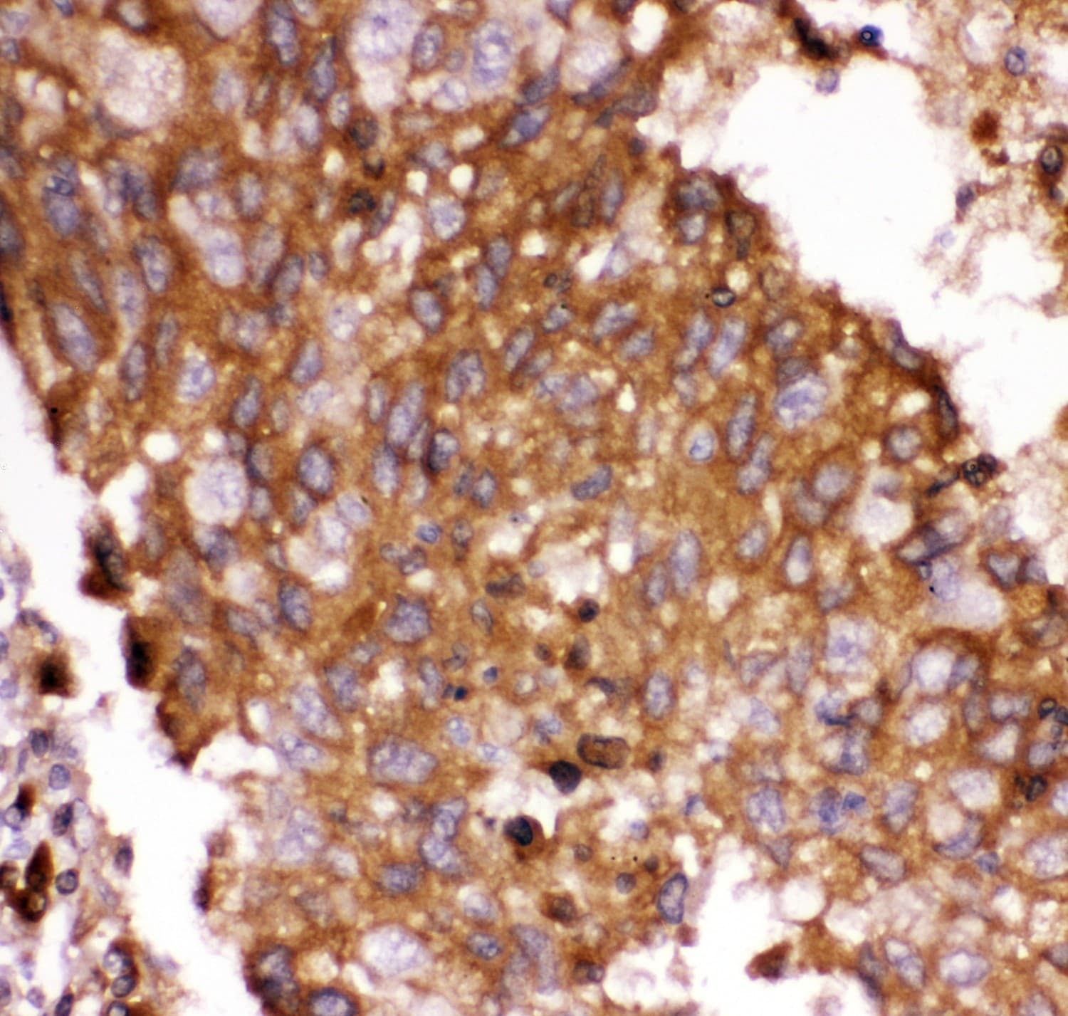 FOXO3 / FOXO3A Antibody (aa471-673)