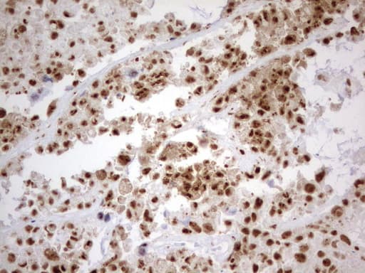 PARN Antibody (aa1-266, clone UMAB143, Carrier-free)