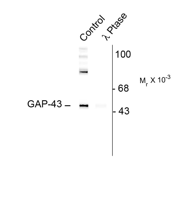 GAP43 Antibody (phospho-Ser41)