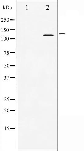 APP / Beta Amyloid Precursor Antibody