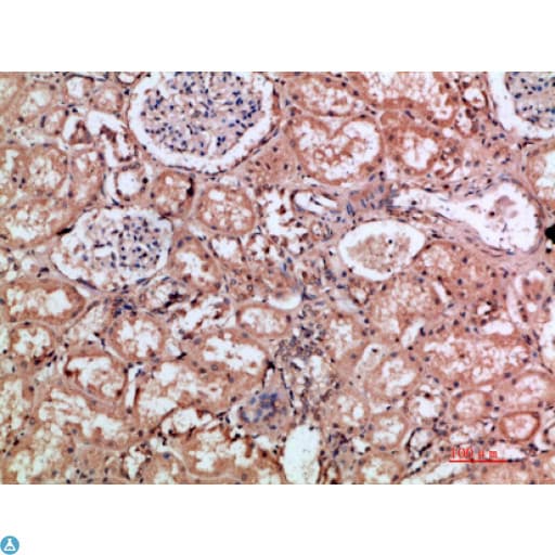 Polyclonal Rabbit anti-Human HMMR / CD168 / RHAMM Antibody (IHC, WB)
