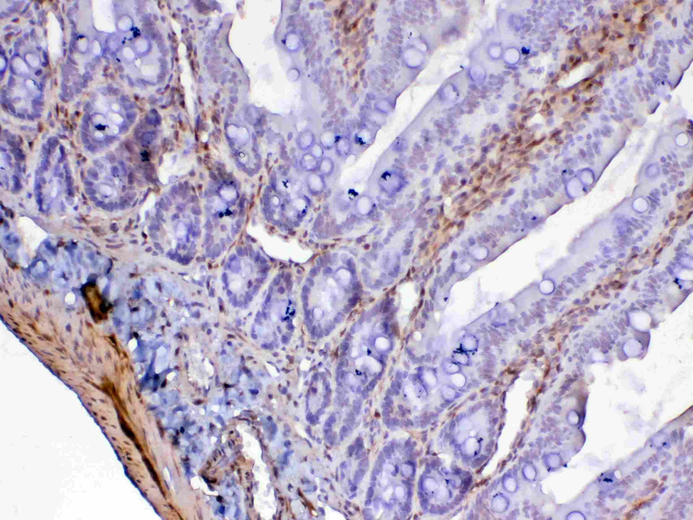 LGALS1 / Galectin 1 Antibody