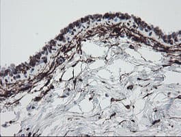 F13A1 / Factor XIIIa Antibody (clone 6F5, Carrier-free)