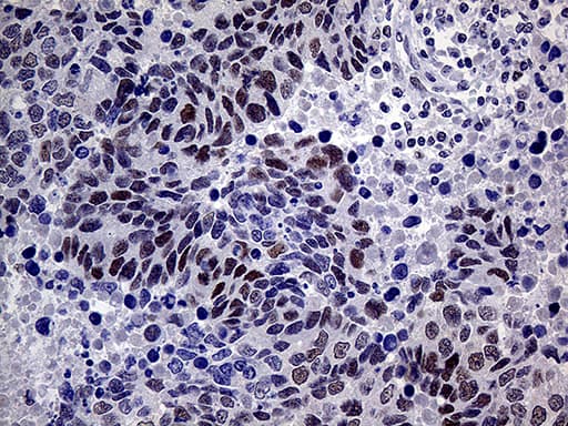 MLH1 Antibody (aa299-527, clone OTI3C1)