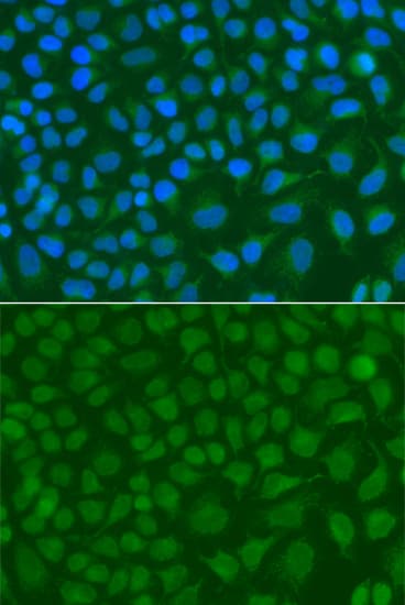 SSX5 Antibody