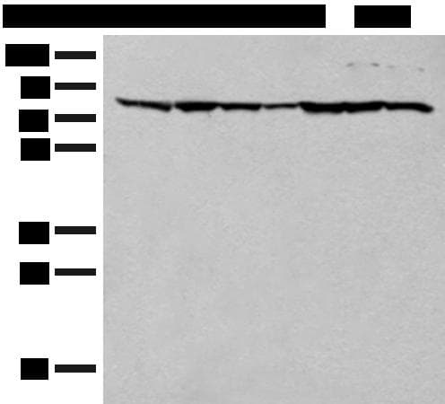 Polyclonal Rabbit anti-Human TUBGCP4 Antibody (WB)