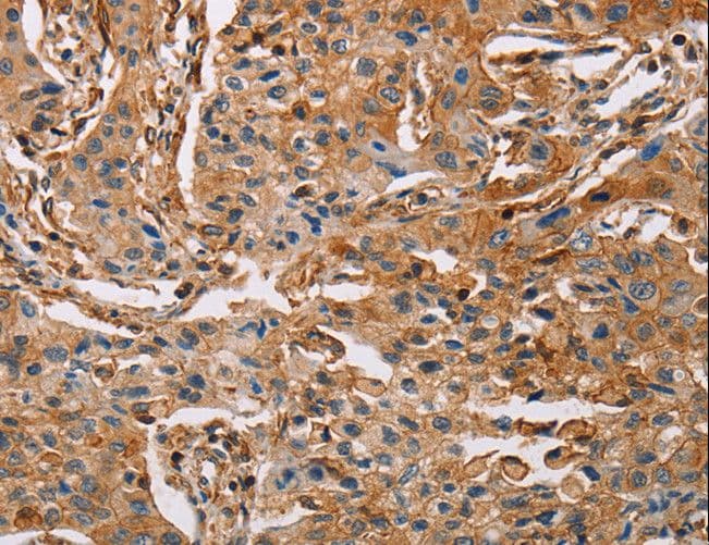 Polyclonal Rabbit anti-Human ACTA1 / Skeletal Muscle Actin Antibody (IHC, WB)