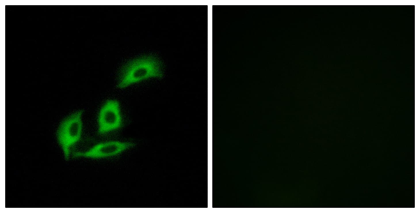 IHC-plus™ NECAB3 Antibody (aa321-370)