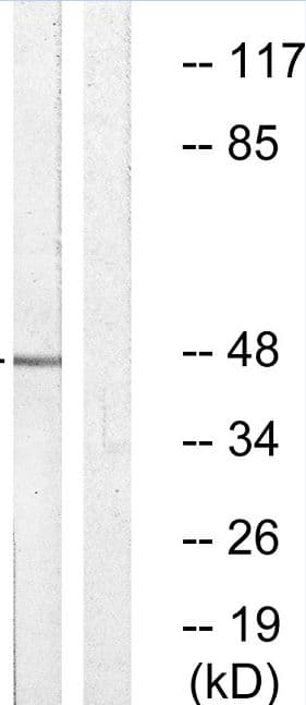 VASP Antibody (phospho-Ser157)
