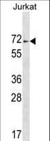 ZNF613 Antibody (aa512-539)
