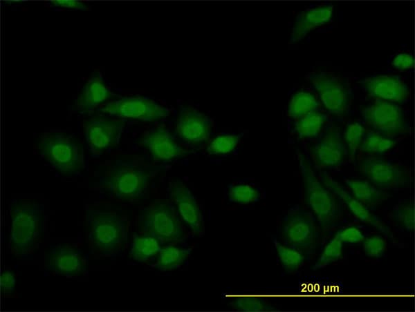 KDM5B / JARID1B Antibody (clone 1G10)