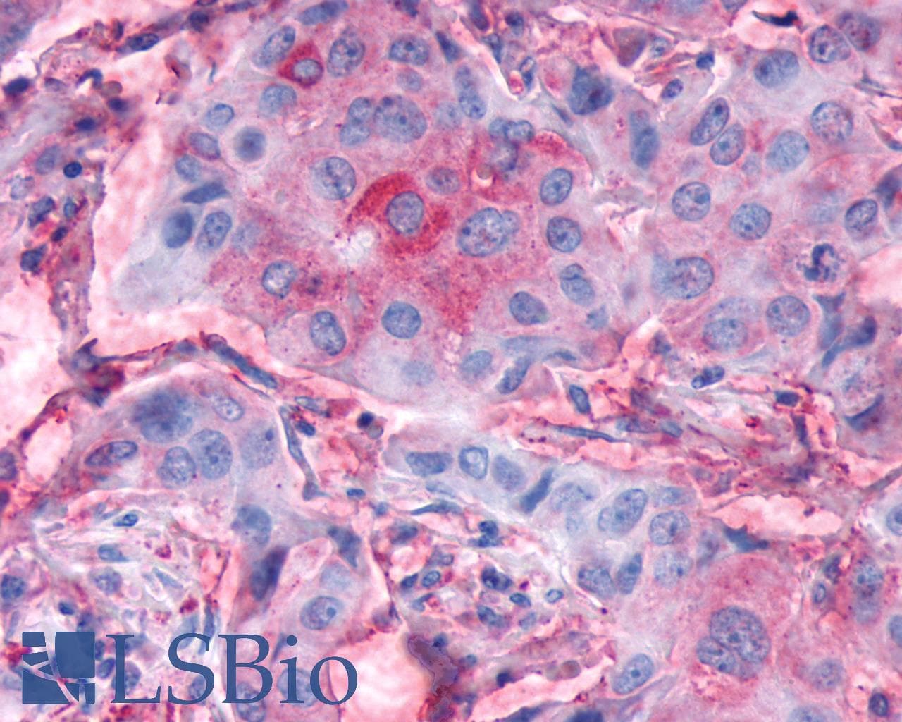 IHC-plus™ FZD4 / Frizzled 4 Antibody (N-Terminus)