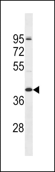 OR2T5 Antibody (aa1-30)