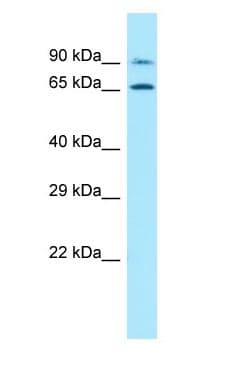 Polyclonal Rabbit anti-Human PALMD Antibody (aa112-161, WB)