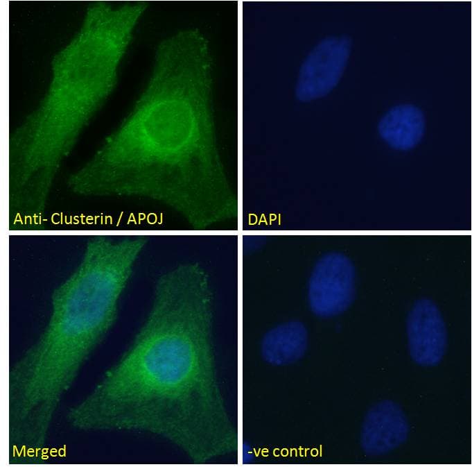 IHC-plus™ CLU / Clusterin Antibody (aa488-501)